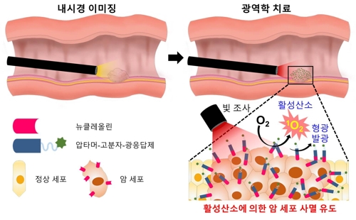 암 표적 광역학 소재를 이용한 내시경·복강경 진단·치료[한국연구재단 제공=연합뉴스]